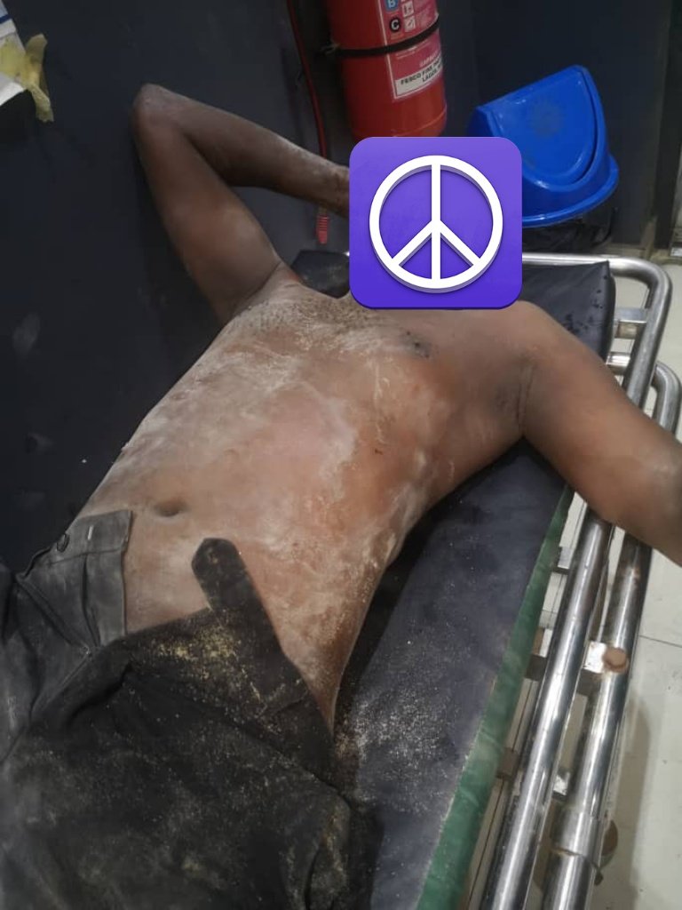 Victims hospitalised after building collapses in Lagos