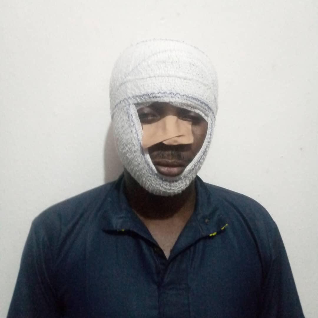 Edo activist brutalised by vigilantes seeks justice